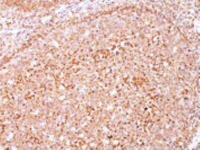 Immunohistochemistry-Paraffin: CD79A Antibody (HM47/A9) [NBP2-44738]