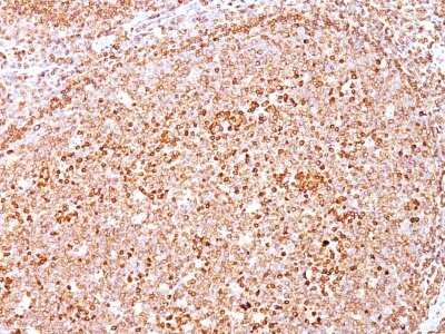Immunohistochemistry-Paraffin: CD79A Antibody (HM47/A9) [NBP2-44738]