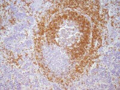 Immunohistochemistry: CD79A Antibody (HM57) - BSA Free [NB100-64347]