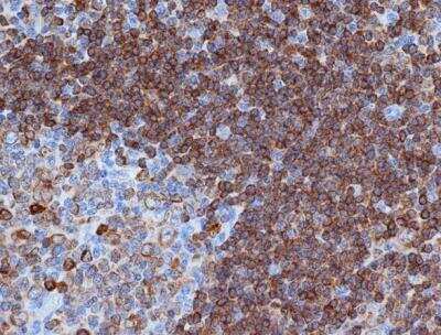 Immunohistochemistry-Paraffin: CD79A Antibody (HM57) - BSA Free [NB100-64347]