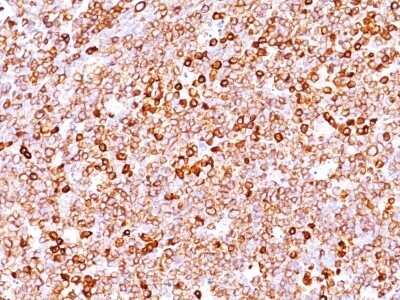 Immunohistochemistry-Paraffin: CD79A Antibody (IGA/1688R) [NBP2-53138]