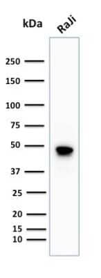 Western Blot: CD79A Antibody (IGA/1688R) [NBP2-53138]