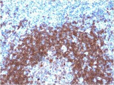 Immunohistochemistry-Paraffin: CD79A Antibody (IGA/1790R) - Azide and BSA Free [NBP3-11617]