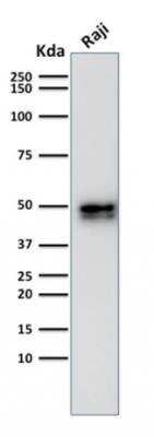 Western Blot: CD79A Antibody (IGA/1790R)Azide and BSA Free [NBP3-11617]