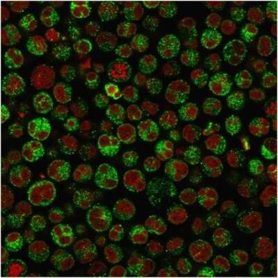 Immunocytochemistry/ Immunofluorescence: CD79A Antibody (IGA/1790R) [NBP2-54608]