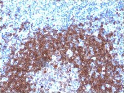 Immunohistochemistry-Paraffin: CD79A Antibody (IGA/1790R) [NBP2-54608]