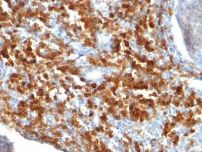 Immunohistochemistry-Paraffin: CD79A Antibody (IGA/515) - Azide and BSA Free [NBP2-47839]