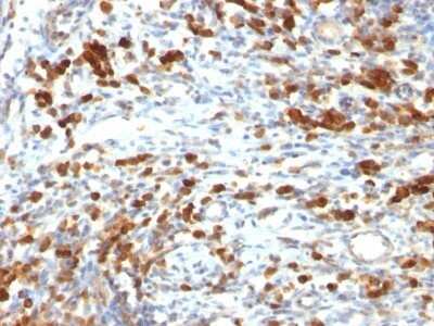 Immunohistochemistry-Paraffin: CD79A Antibody (IGA/764) - IHC-Prediluted [NBP2-48029]