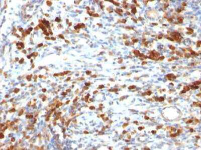 Immunohistochemistry-Paraffin: CD79A Antibody (IGA/764) [NBP2-44741]