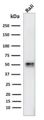 Western Blot: CD79A Antibody (IGA/764) [NBP2-44741]