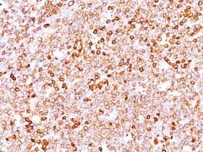 Immunohistochemistry-Paraffin: CD79A Antibody (JCB117 + HM47/A9) - Azide and BSA Free [NBP2-34653]