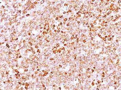 Immunohistochemistry-Paraffin: CD79A Antibody (JCB117 + HM47/A9) - IHC-Prediluted [NBP2-44740]