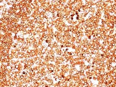 Immunohistochemistry-Paraffin: CD79A Antibody (JCB117 + HM47/A9) [NBP2-34330]
