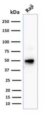 Western Blot: CD79A Antibody (JCB117 + HM47/A9) [NBP2-34330]