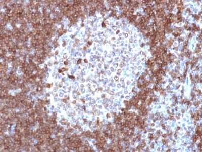 Immunohistochemistry-Paraffin: CD79A Antibody (JCB117) - Azide and BSA Free [NBP2-34652]
