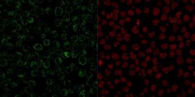 Immunocytochemistry/ Immunofluorescence: CD79A Antibody (JCB117) [NBP2-32949]