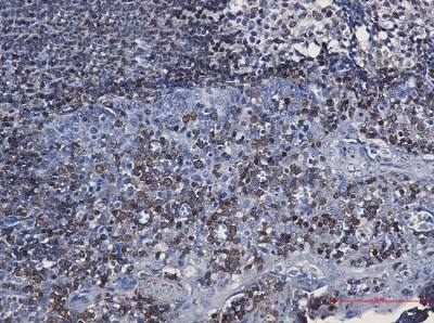 Immunohistochemistry-Paraffin: CD79A Antibody (S02-7E3) [NBP3-19601]