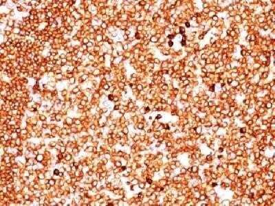 Immunohistochemistry-Paraffin: CD79A Antibody (SPM549) - Azide and BSA Free [NBP2-34791]