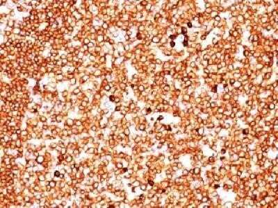 Immunohistochemistry-Paraffin: CD79A Antibody (SPM549) - IHC-Prediluted [NBP2-44737]