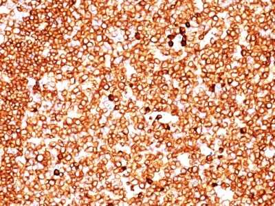 Immunohistochemistry-Paraffin: CD79A Antibody (SPM549) [NBP2-32833]
