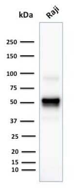 Western Blot: CD79A Antibody (SPM549) [NBP2-32833]