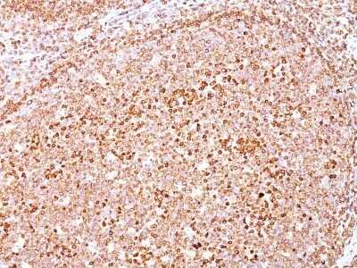 Immunohistochemistry-Paraffin: CD79A Antibody (SPM550) - Azide and BSA Free [NBP2-34792]