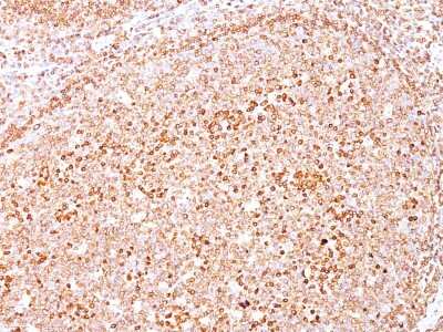 Immunohistochemistry-Paraffin: CD79A Antibody (SPM550) [NBP2-32834]