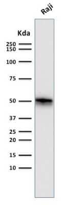 Western Blot: CD79A Antibody (SPM550) [NBP2-32834]