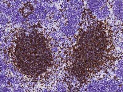 Immunohistochemistry-Paraffin: CD79B Antibody (003) [NBP2-90705]