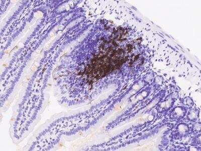 Immunohistochemistry-Paraffin: CD79B Antibody (003) [NBP2-90705]