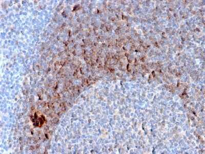 Immunohistochemistry-Paraffin: CD79B Antibody (B29/123) - Azide and BSA Free [NBP3-08356]