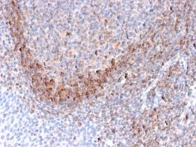 Immunohistochemistry-Paraffin: CD79B Antibody (B29/123) - Azide and BSA Free [NBP3-08356]