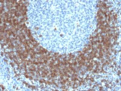 Immunohistochemistry-Paraffin: CD79B Antibody (IGB/1842) - Azide and BSA Free [NBP3-08219]