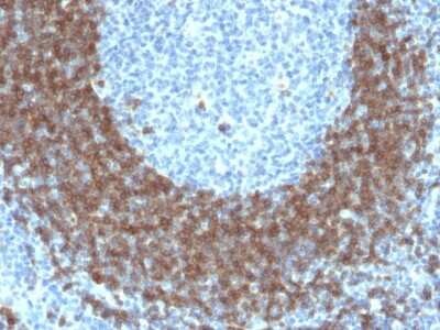 Immunohistochemistry-Paraffin: CD79B Antibody (IGB/1842) [NBP3-07226]