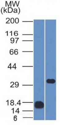 Western Blot: CD79B Antibody (IGB/1843)Azide and BSA Free [NBP3-08596]