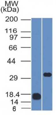 Western Blot: CD79B Antibody (IGB/1843) [NBP3-07418]