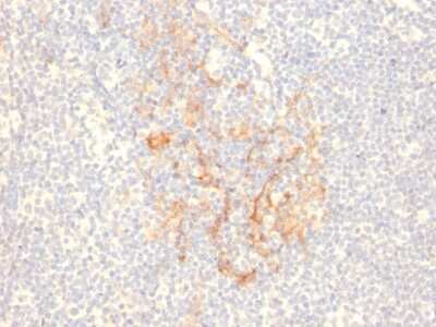 Immunohistochemistry-Paraffin: CD79B Antibody (IGB/2555) - Azide and BSA Free [NBP3-08603]