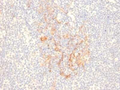 Immunohistochemistry-Paraffin: CD79B Antibody (IGB/2555) [NBP3-07420]