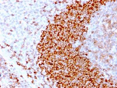 Immunohistochemistry-Paraffin: CD79B Antibody (IGB/3170R) - Azide and BSA Free [NBP3-08794]