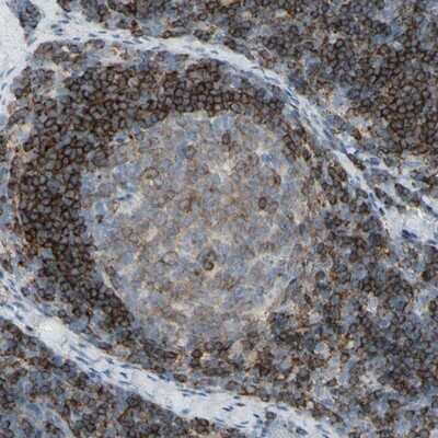 Immunohistochemistry-Paraffin: CD79B Antibody [NBP1-88945]