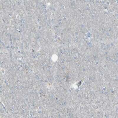 Immunohistochemistry-Paraffin: CD79B Antibody [NBP1-88945]