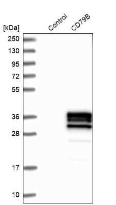 Western Blot: CD79B Antibody [NBP1-88945]