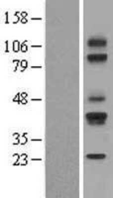 Western Blot: CD79A Overexpression Lysate [NBL1-08969]