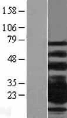 Western Blot: CD79B Overexpression Lysate [NBL1-08970]