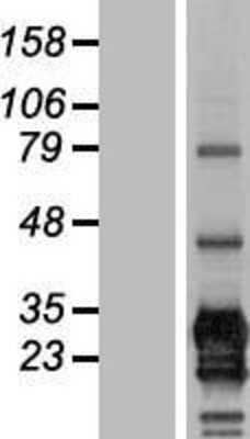 Western Blot: CD79B Overexpression Lysate [NBL1-08971]