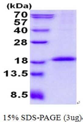 SDS-PAGE: Recombinant Human CD79B His Protein [NBP2-22759]