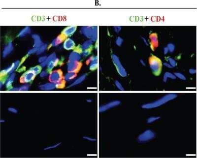 Immunohistochemistry: CD8 Antibody (12.C7) - BSA Free [NB100-64021]