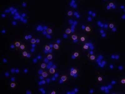 Immunocytochemistry/ Immunofluorescence: CD8 Antibody (53-6.7) - Azide and BSA Free [NBP2-80658]
