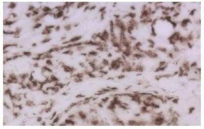 Immunohistochemistry: CD8 Antibody (53-6.7) - Azide and BSA Free [NBP2-80658]