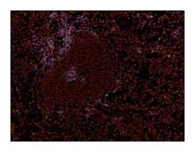 Immunohistochemistry-Paraffin: CD8 Antibody (53-6.7) - Azide and BSA Free [NBP2-80658]